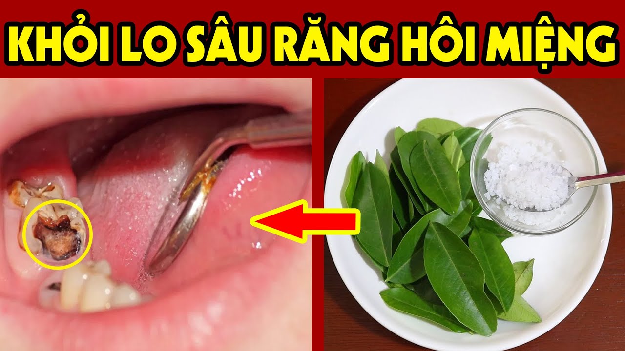 Thảo dược dân dã chữa đau răng hiệu quả