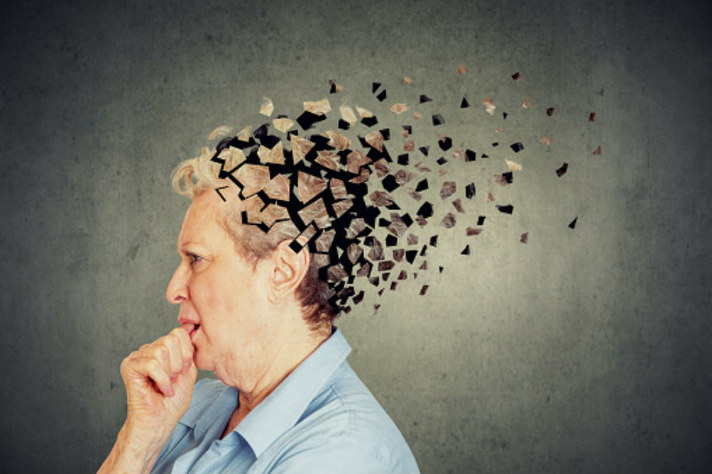 Bệnh Alzheimer là gì?